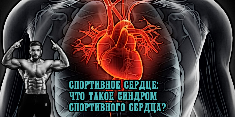 Спортивное сердце: что такое синдром спортивного сердца?
